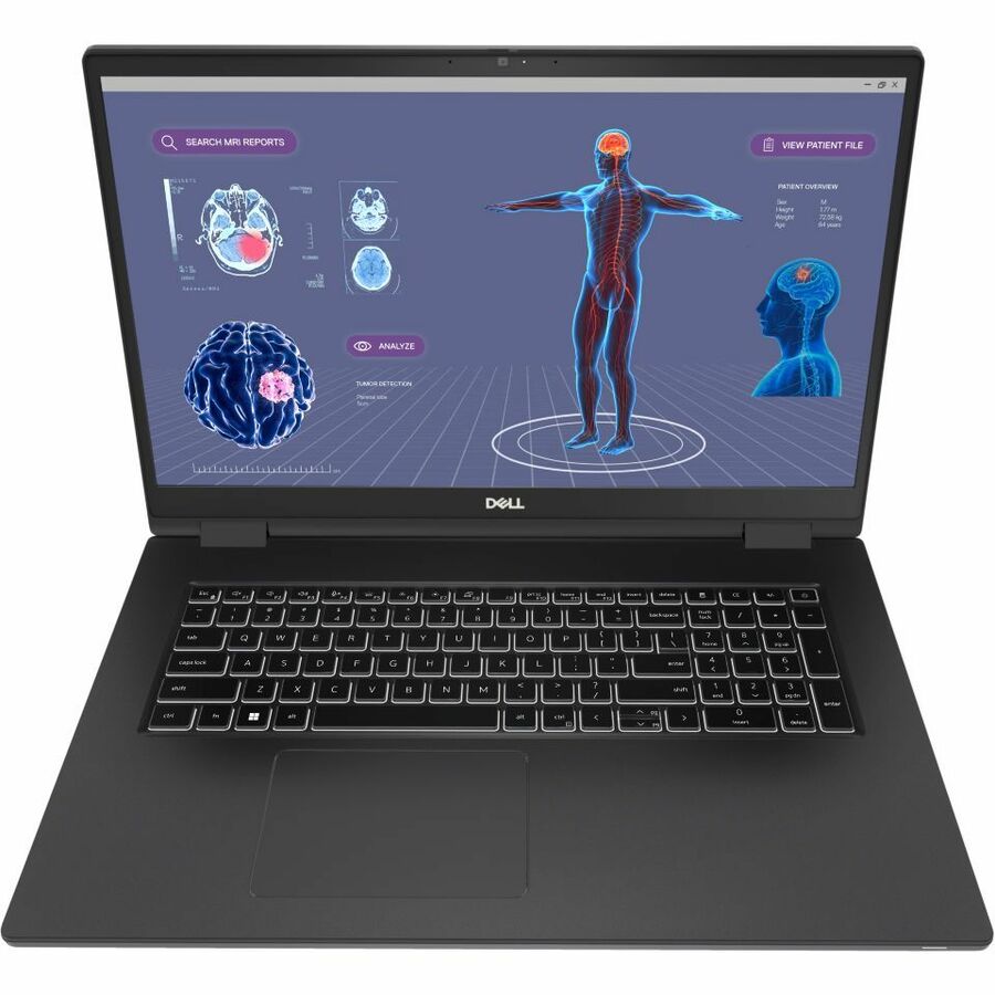 Dell Precision 7000 7780 17.3" Mobile Workstation - Full HD - 1920 x 1080 - Intel Core i7