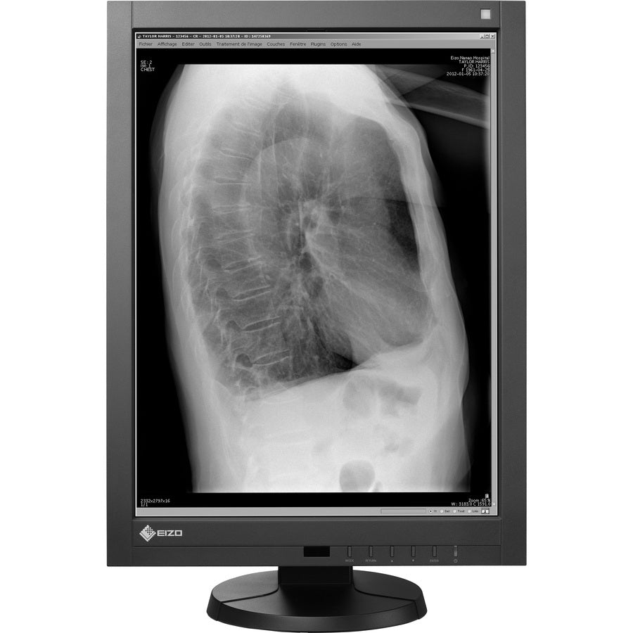 Eizo Radiforce Gx240-Cl-P 21.3" Uxga Led Lcd Monitor - 4:3 - Black