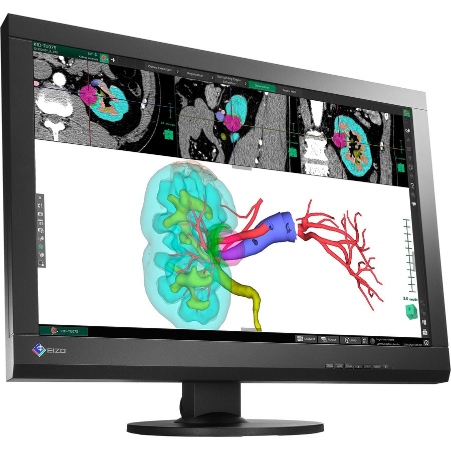 Eizo Radiforce Mx242W 24.1" Wuxga Led Lcd Monitor - 16:10 - Black