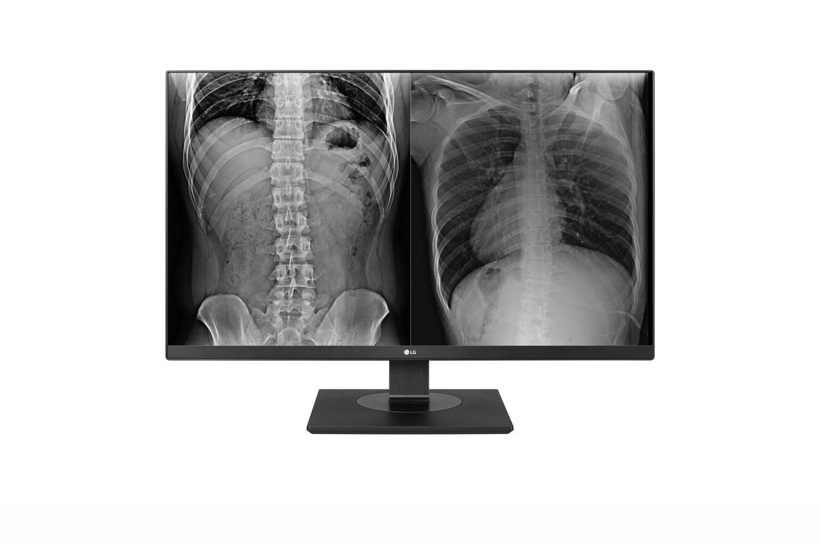 Medical Grade Monitor - 8MP Clinical Review Display | LG 27HJ713C-B
