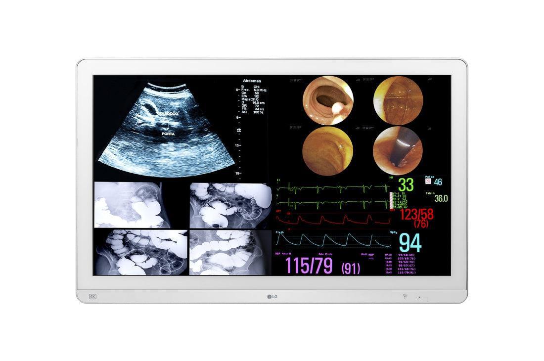 Surgical Monitor 4K - LG 31.5" IPS Medical Display | Tecisoft 32HL714S-W