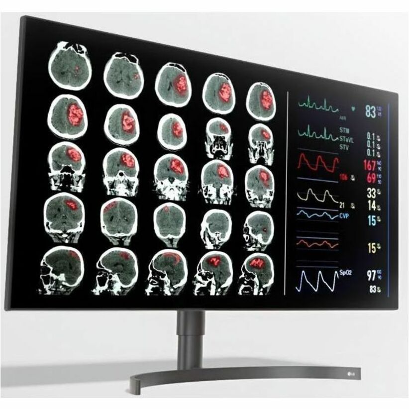 8MP Diagnostic Monitor - Medical Imaging Display | 32HQ713D-B