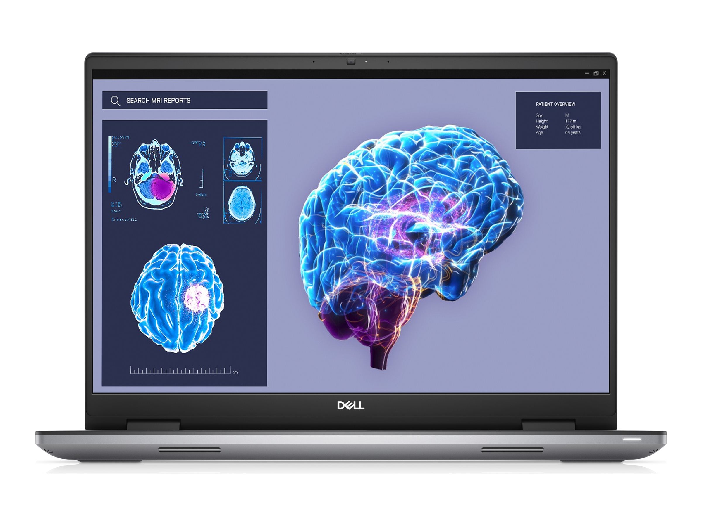 Dell Precision 7680 - Intel Core i7 - 13850HX / up to 5.3 GHz - vPro Enterprise - Win 11 Pro - RTX 1000 Ada - 32 GB RAM - 512 C3NR9