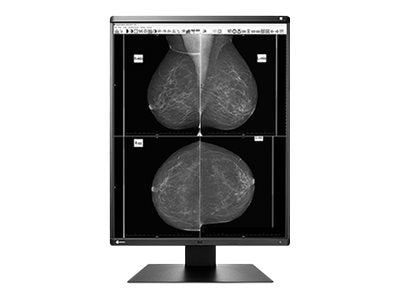 EIZO RadiForce GX560 - LED monitor - 5MP - grayscale - 21.3 - 2048 x 2560 - IPS - 2500 cd/mï¿½ - 1700:1 - 12 ms - DVI-D