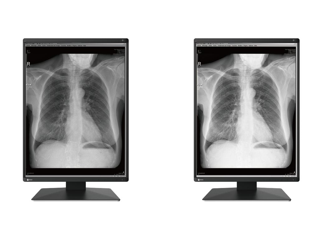 EIZO RadiForce RX370 - LED monitor - 3MP - color - 21.3 - 1536 x 2048 - IPS - 1100 cd/mï¿½ - 1800:1 - 25 ms - DVI-D RX370-BK-SG
