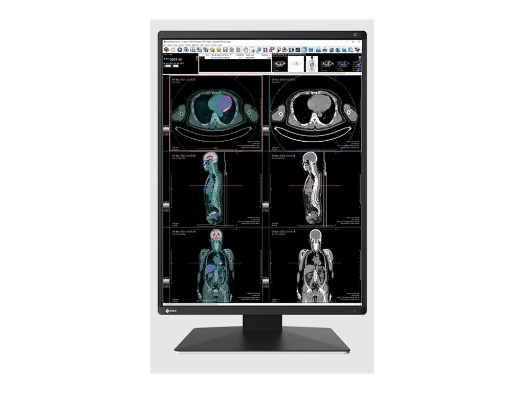 EIZO RadiForce RX370 - LED monitor - 3MP - color - 21.3 - 1536 x 2048 - IPS - 1100 cd/mï¿½ - 1800:1 - 25 ms - DVI-D RX370-BK-SG