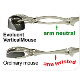 Evoluent Verticalmouse 4 Right Mouse - Optical - Cable - Usb 2.0 - Scroll Wheel