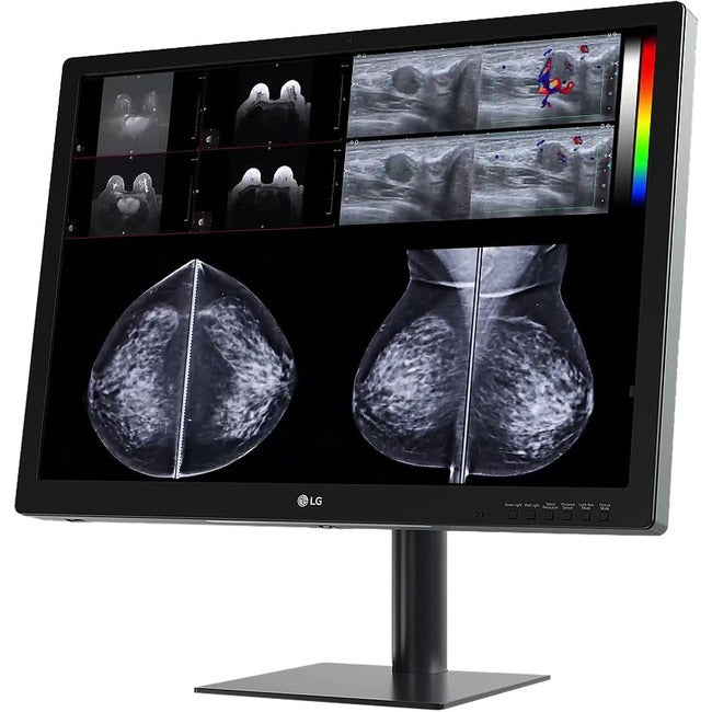 LG 31HN713D-B 31" 12MP IPS Diagnostic Monitor