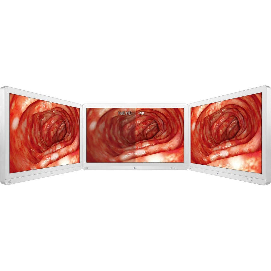Lg 32Hl714S-W Computer Monitor 80 Cm (31.5") 3840 X 2160 Pixels 4K Ultra Hd White