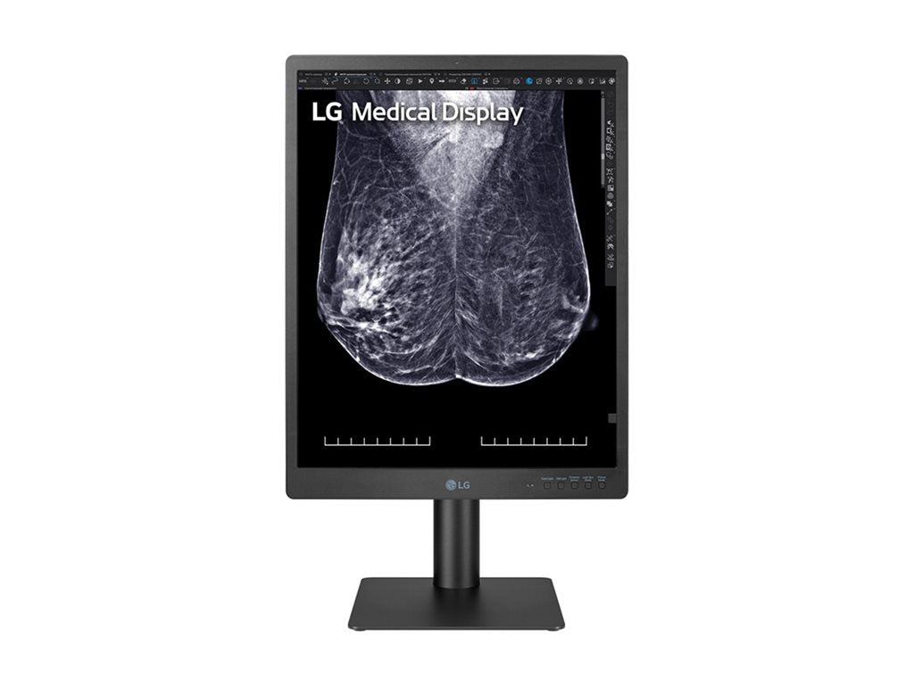 Mammography Monitor - LG 21.3" 5MP IPS Diagnostic Display | Medical Imaging 21HQ613D-B