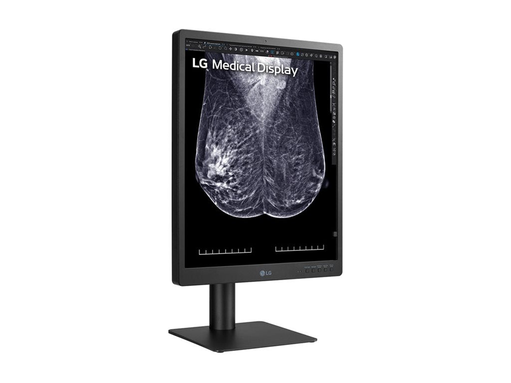 Mammography Monitor - LG 21.3" 5MP IPS Diagnostic Display | Medical Imaging 21HQ613D-B