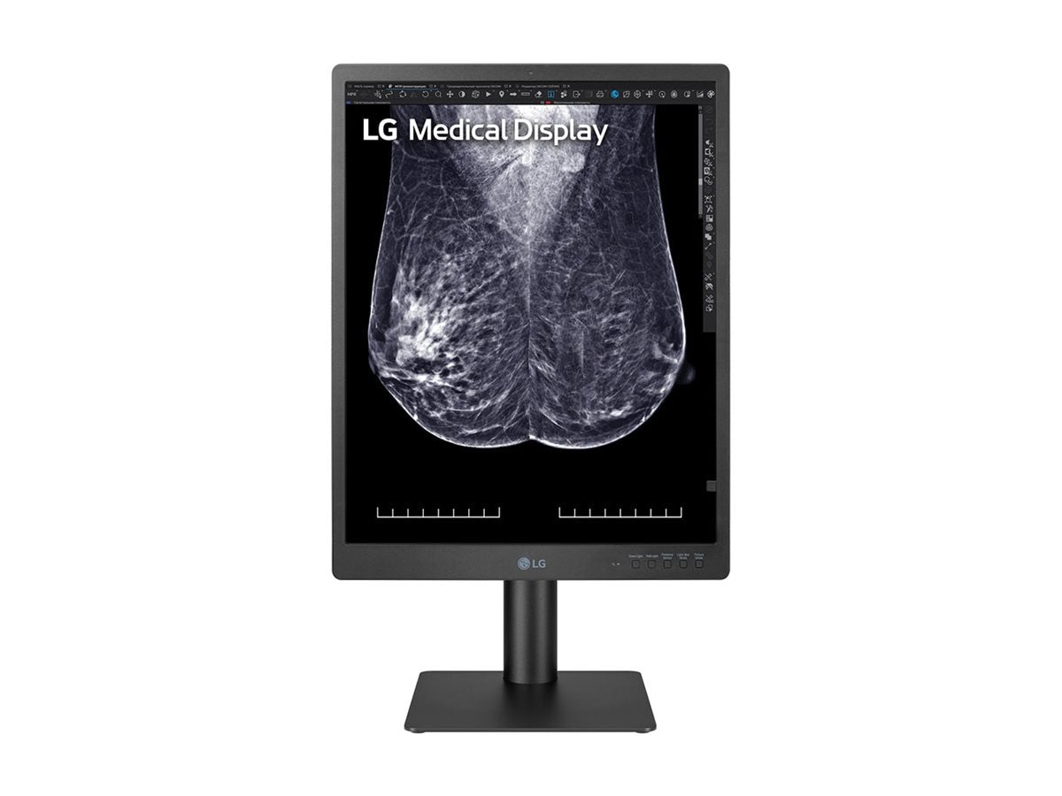 Mammography Monitor - LG 21.3" 5MP IPS Diagnostic Display | Medical Imaging 21HQ613D-B