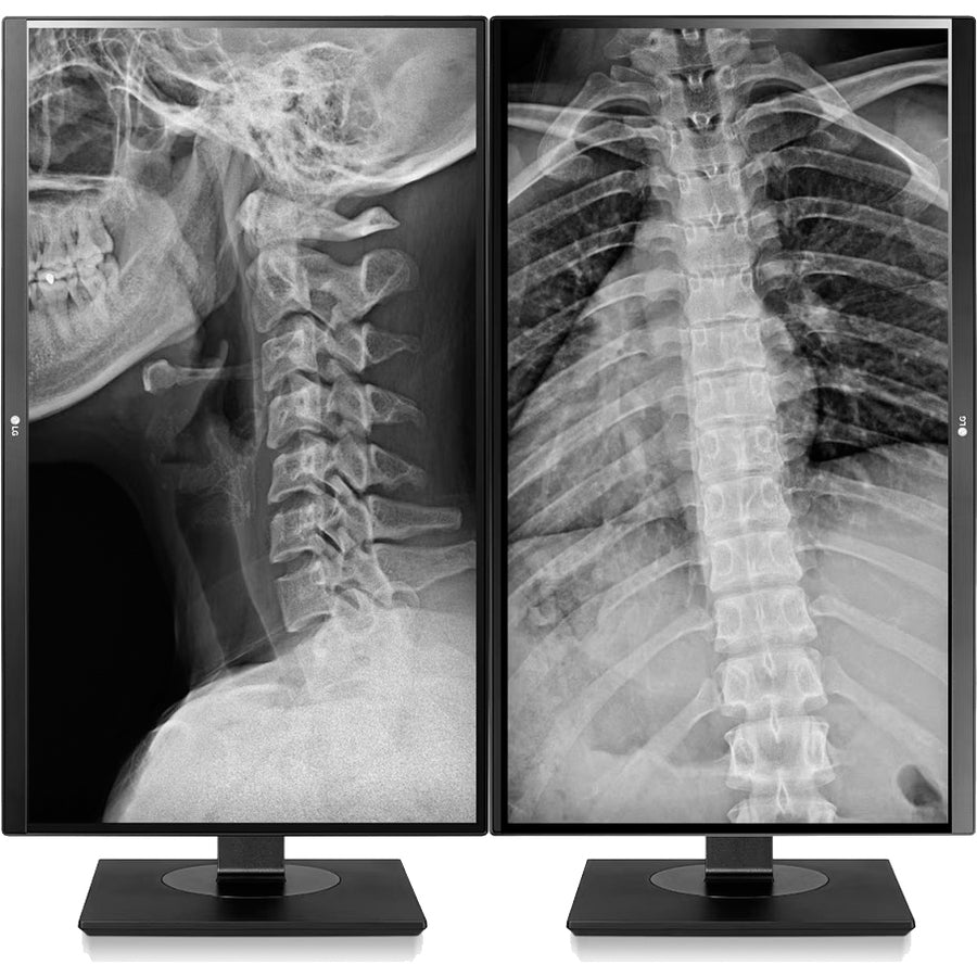 Medical Grade Monitor - 8MP Clinical Review Display | LG 27HJ713C-B