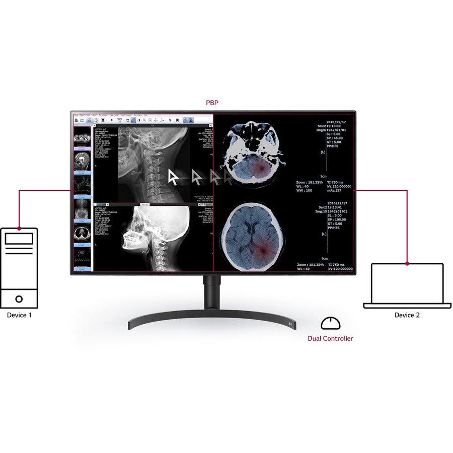 Medical Imaging Monitor 32 Inch - DICOM Calibrated Nano IPS Display | LG 32HL512D-B